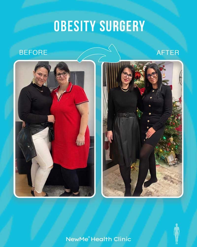 Weight loss surgery before and after — NewMe Health Clinic patient